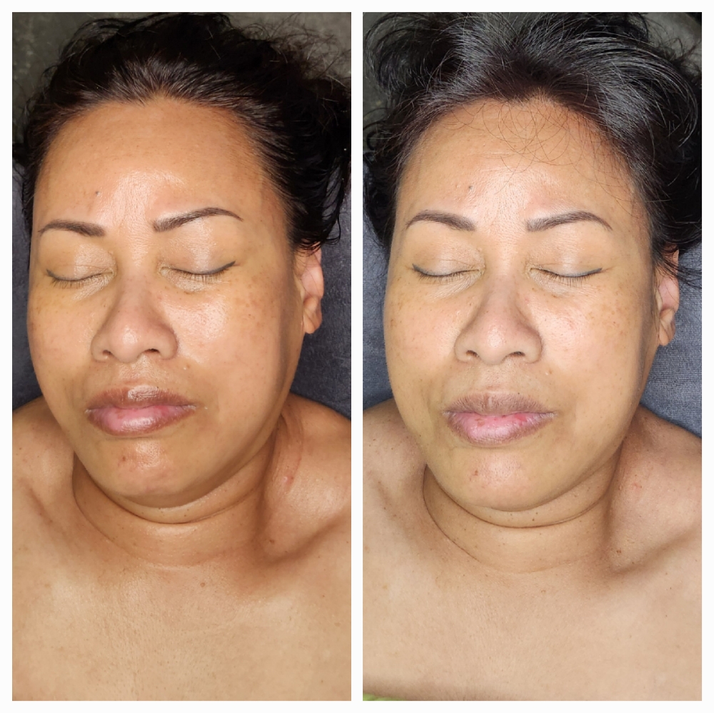 Turn back the Clock Enzyme Facial