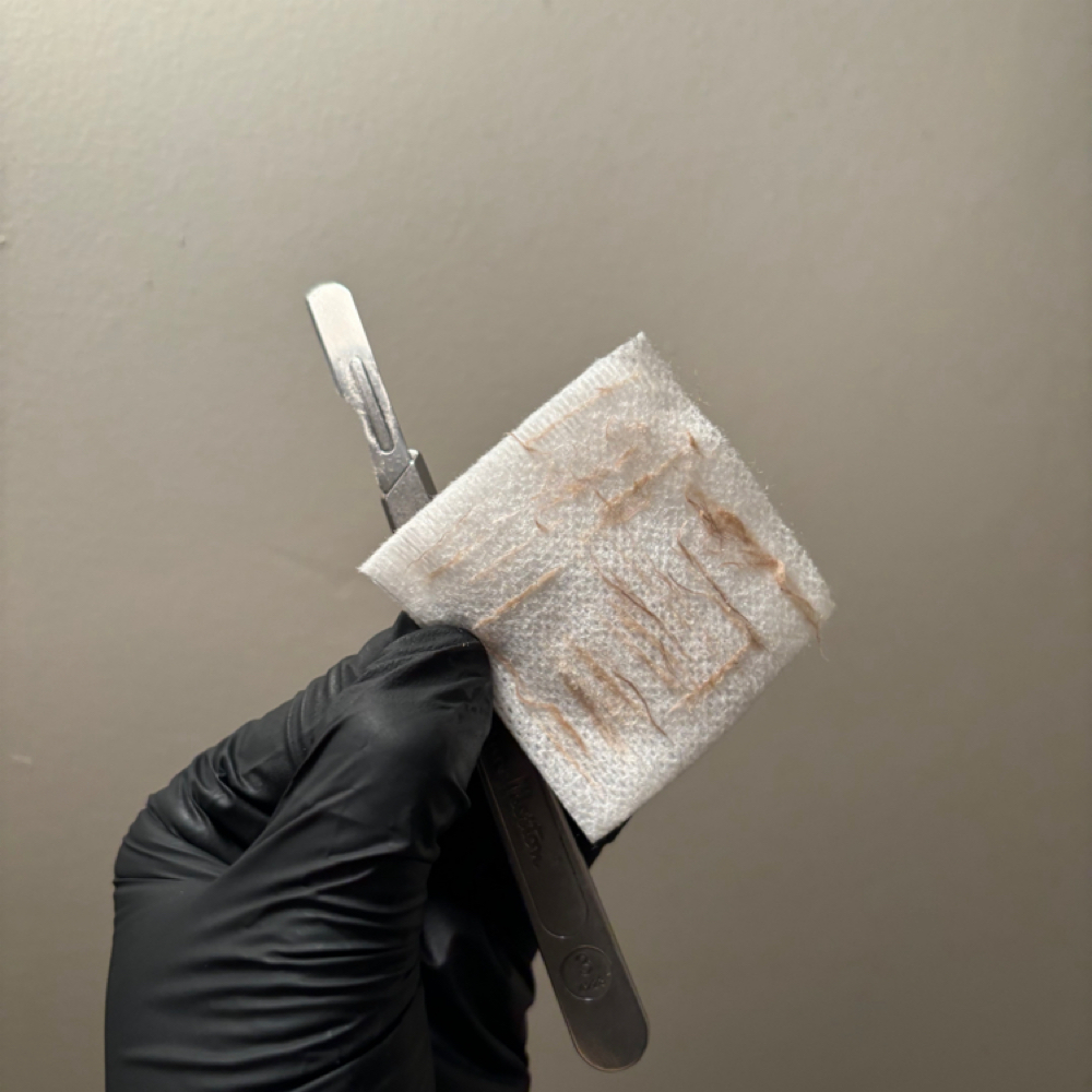 Oxygen Infusion Dermaplane Facial at The Dermal Clinic in Lodi, CA