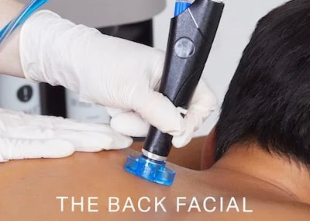 Hydrafacial back (add On)