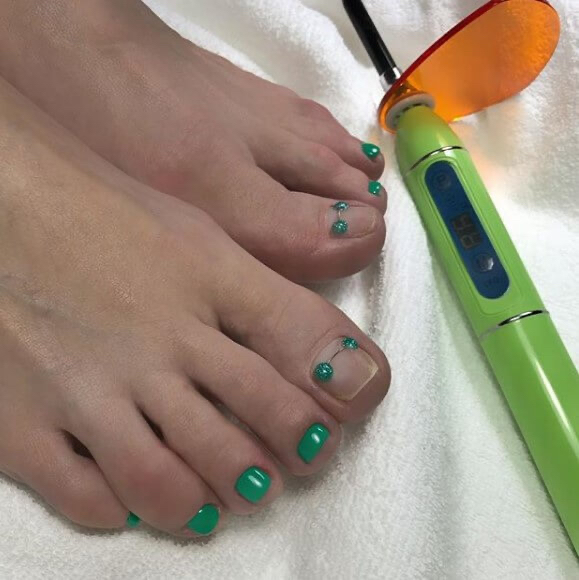 Treatment of Ingrown 2 big toenails