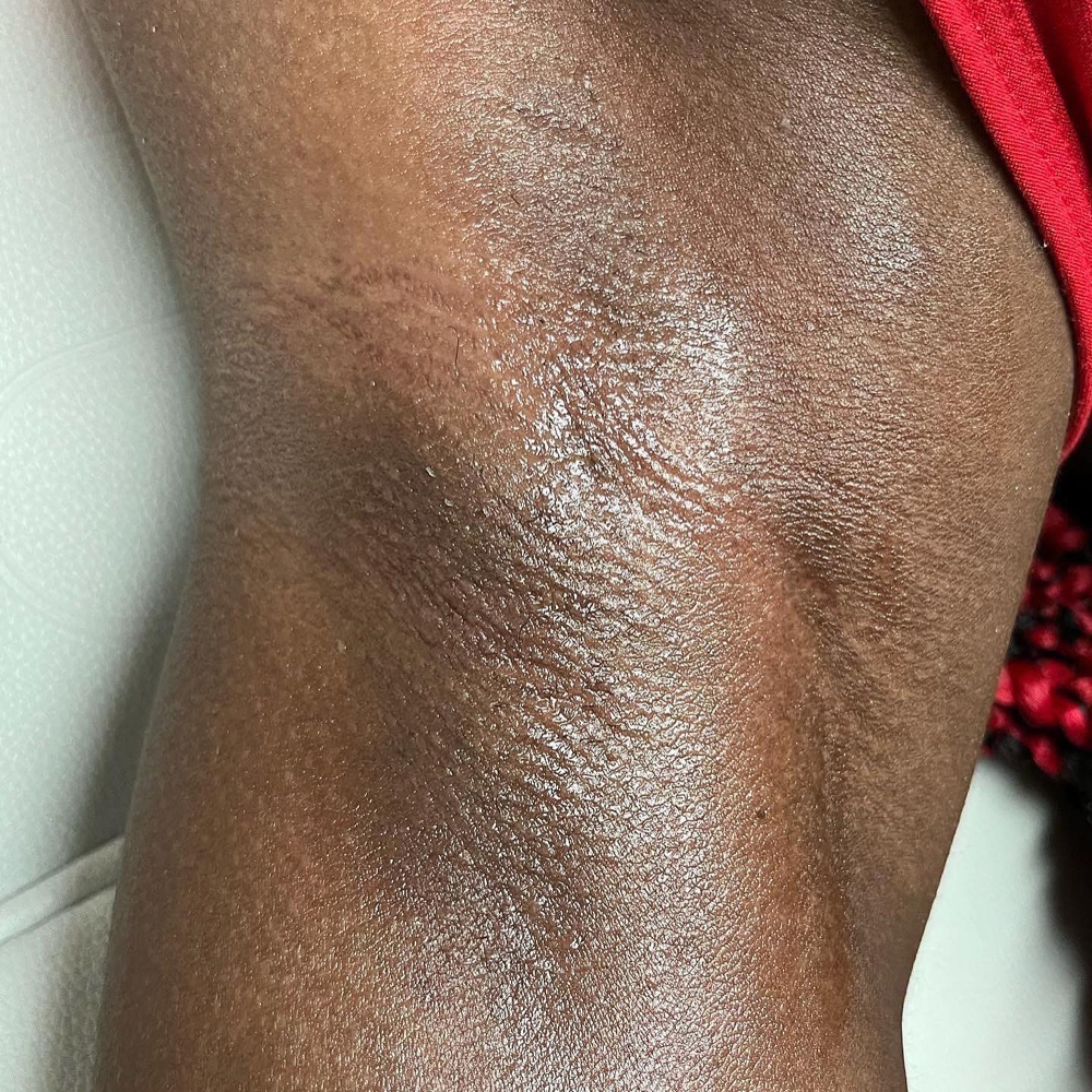 Under Arm Wax