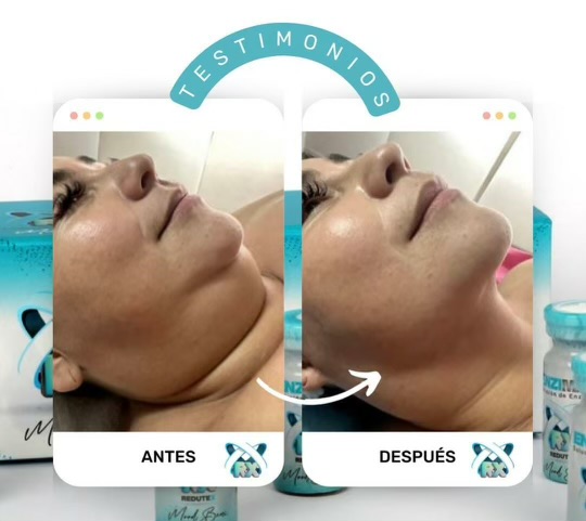 Double Chin / Quemador De Papada