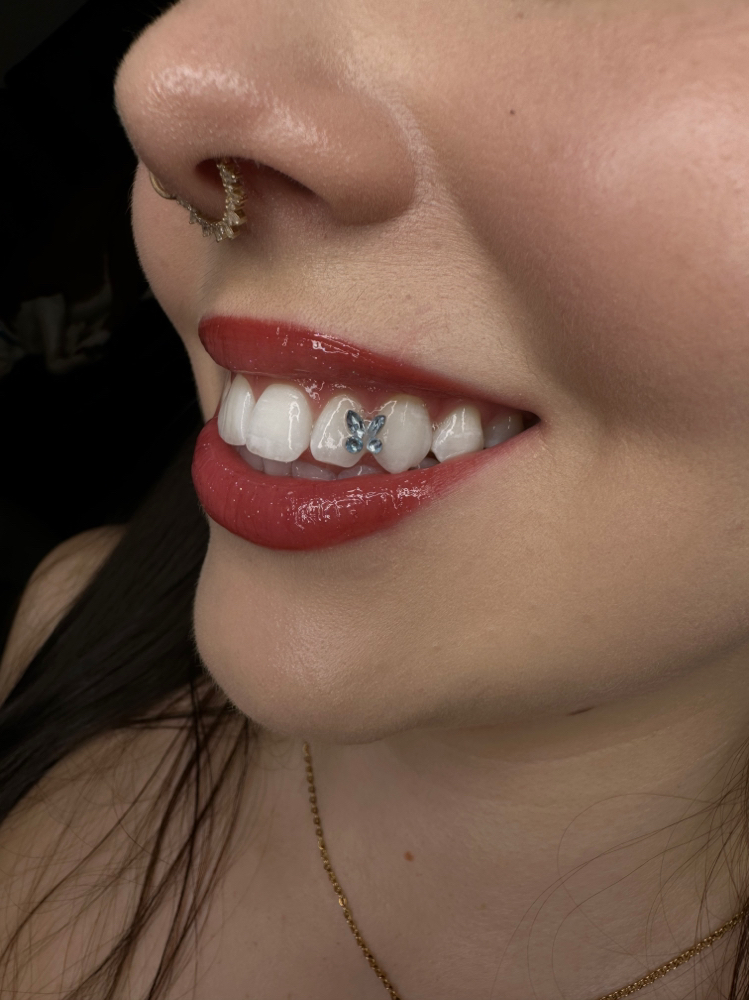Butterfly Design Tooth Gem