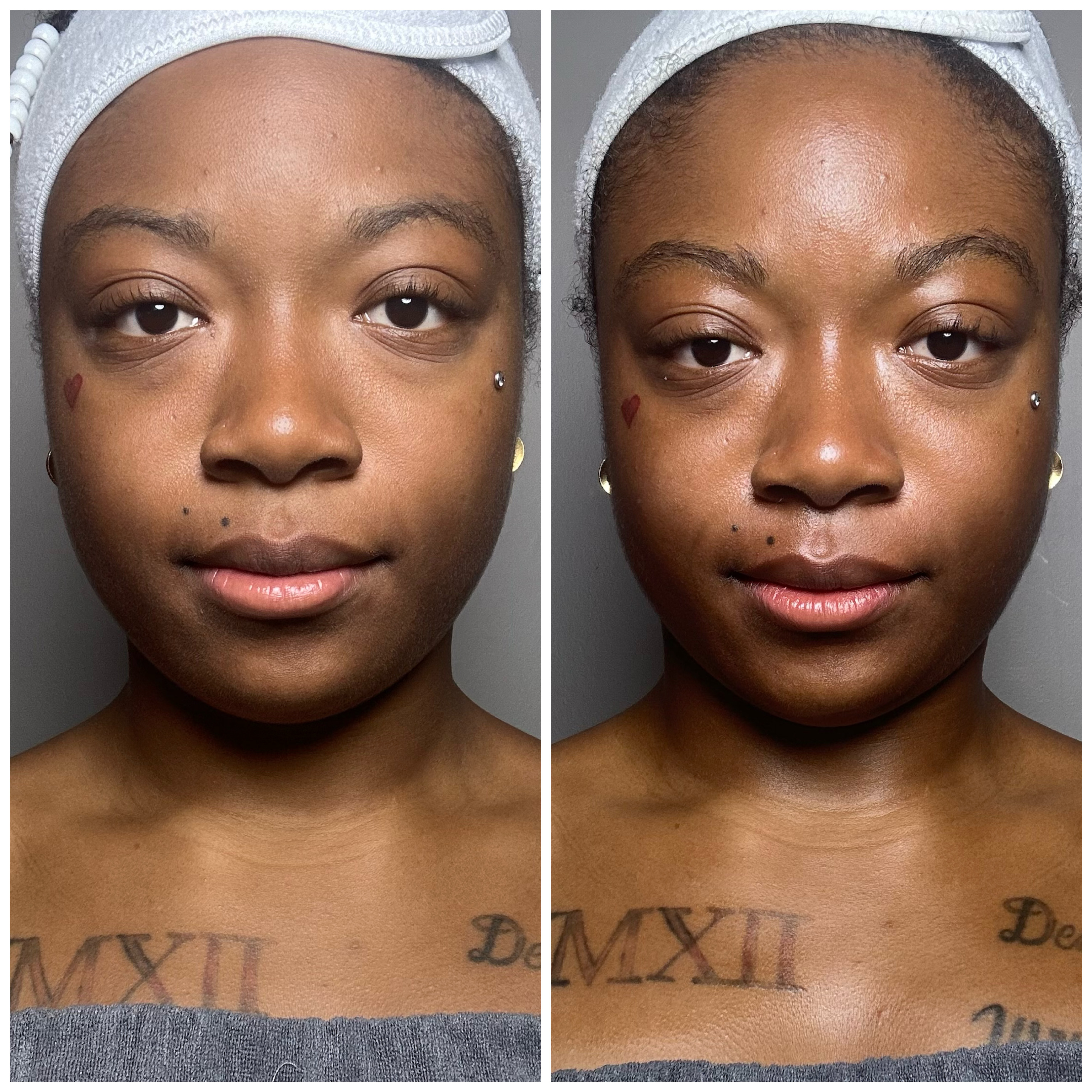 Face Endermologie (lymph/ Glow ) at Anastasia’s Crown in Pittsburgh (Shadyside Area), PA