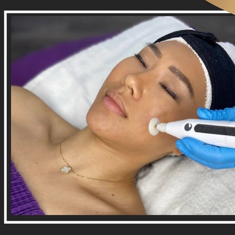 Korean Cold Plasma Facial at C. Walker Skin Company in Cookeville, TN