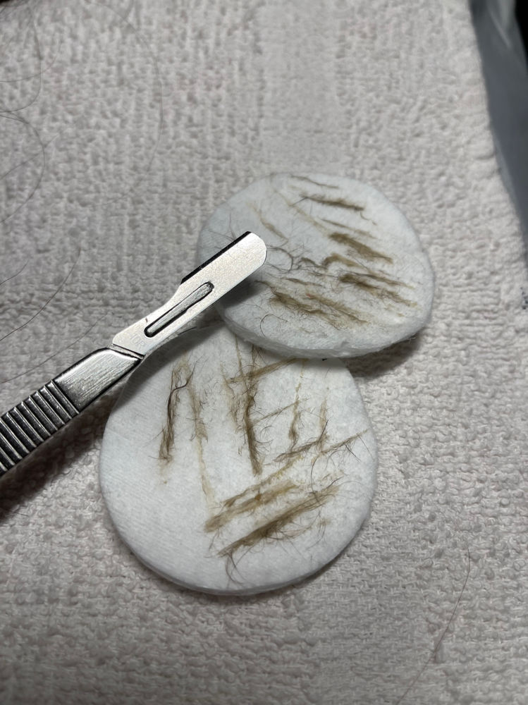 Dermaplane | Luxe