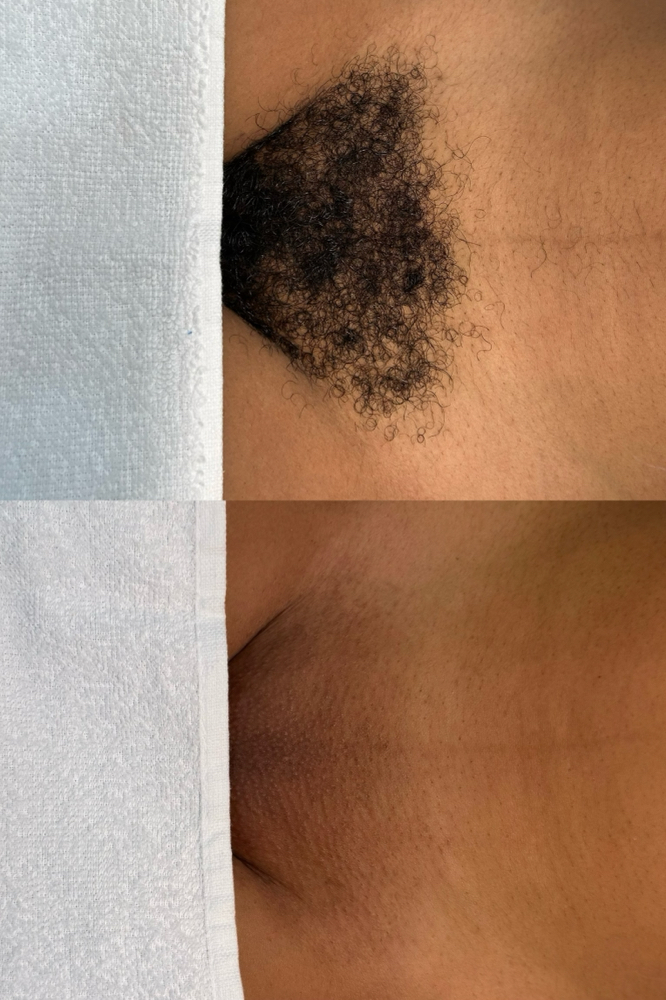 Brazilian Wax at JE Beauty & spa in duluth, GA