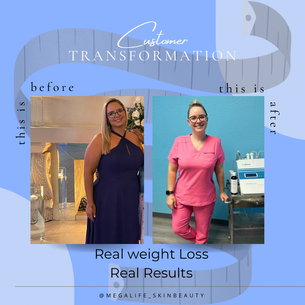 Weight Loss Consultation