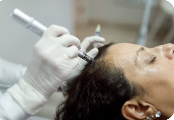 Intro Offer Microneedling For Scalp