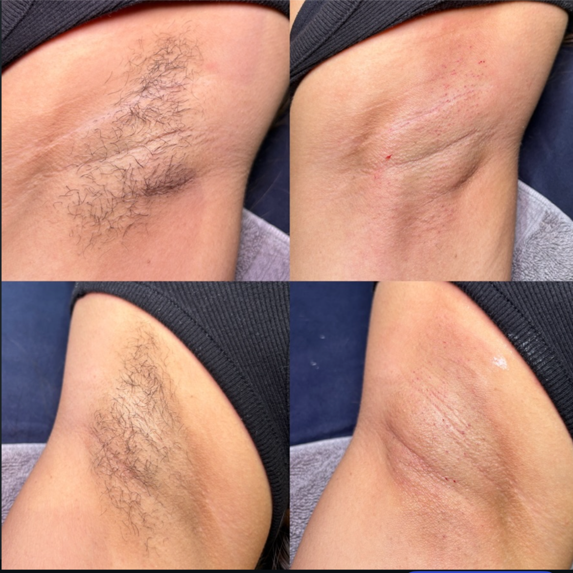 Underarm Wax at Moss & Moon in Pflugerville, TX