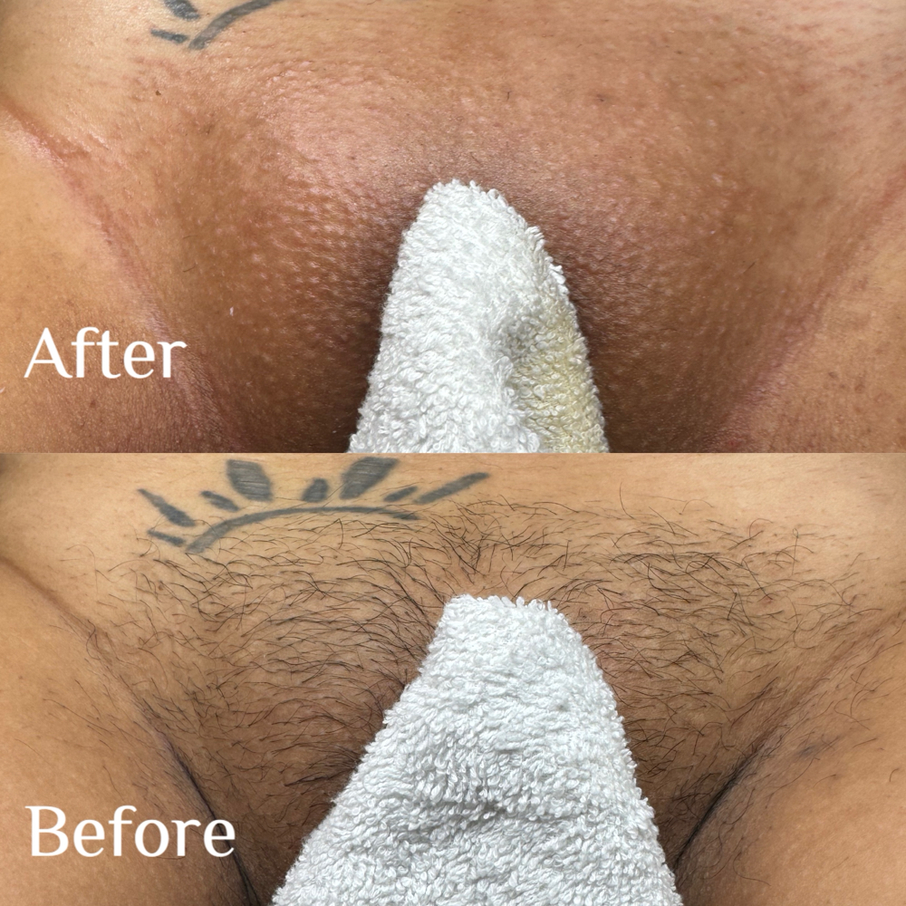 Brazilian Wax