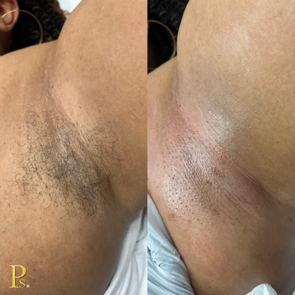 Under Arm Wax