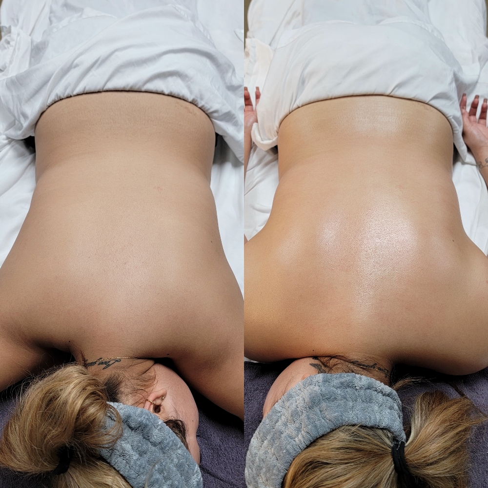Basic back Facial