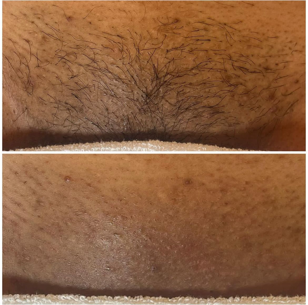 Bikini Wax w/Vajacial at Shai Marie Beauté in Farmington, MI