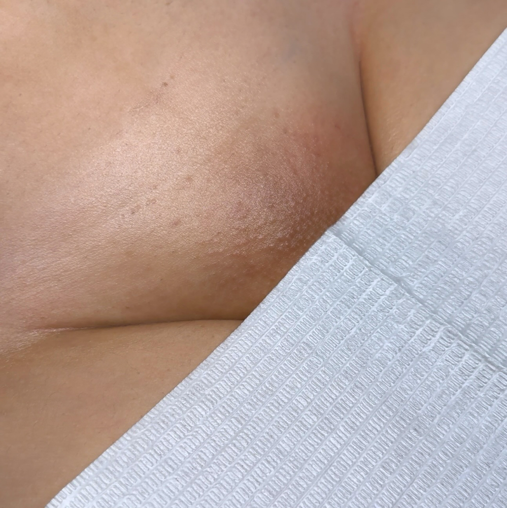 Brazilian Wax
