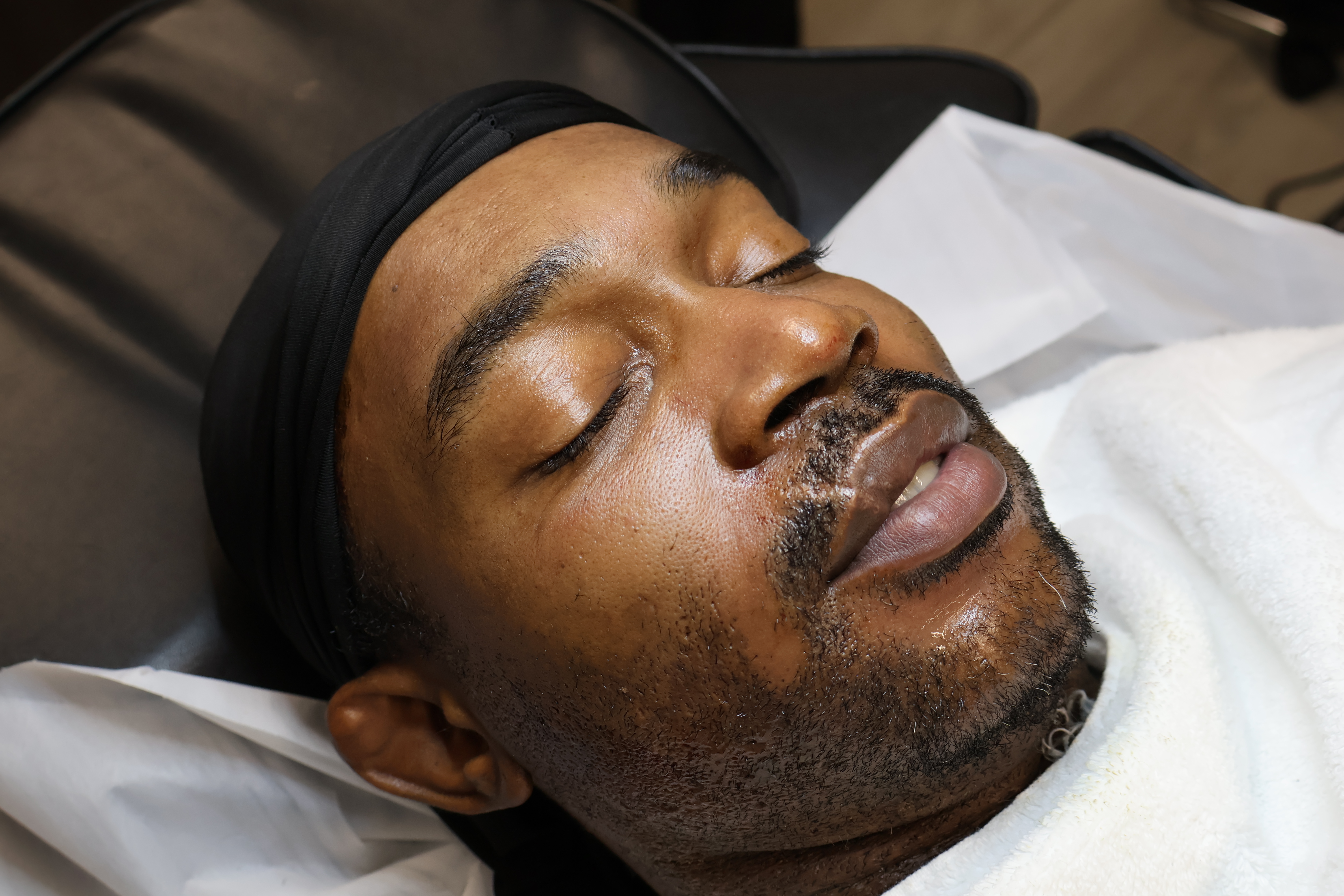 Spooky Microneedling