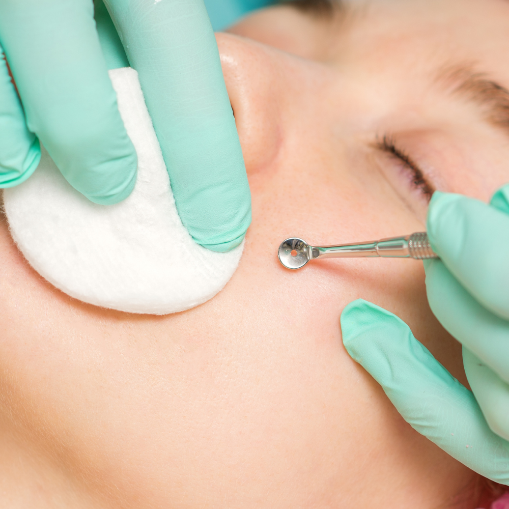 Extraction Facial