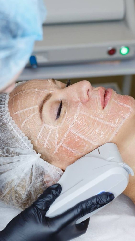 Hifu Facial