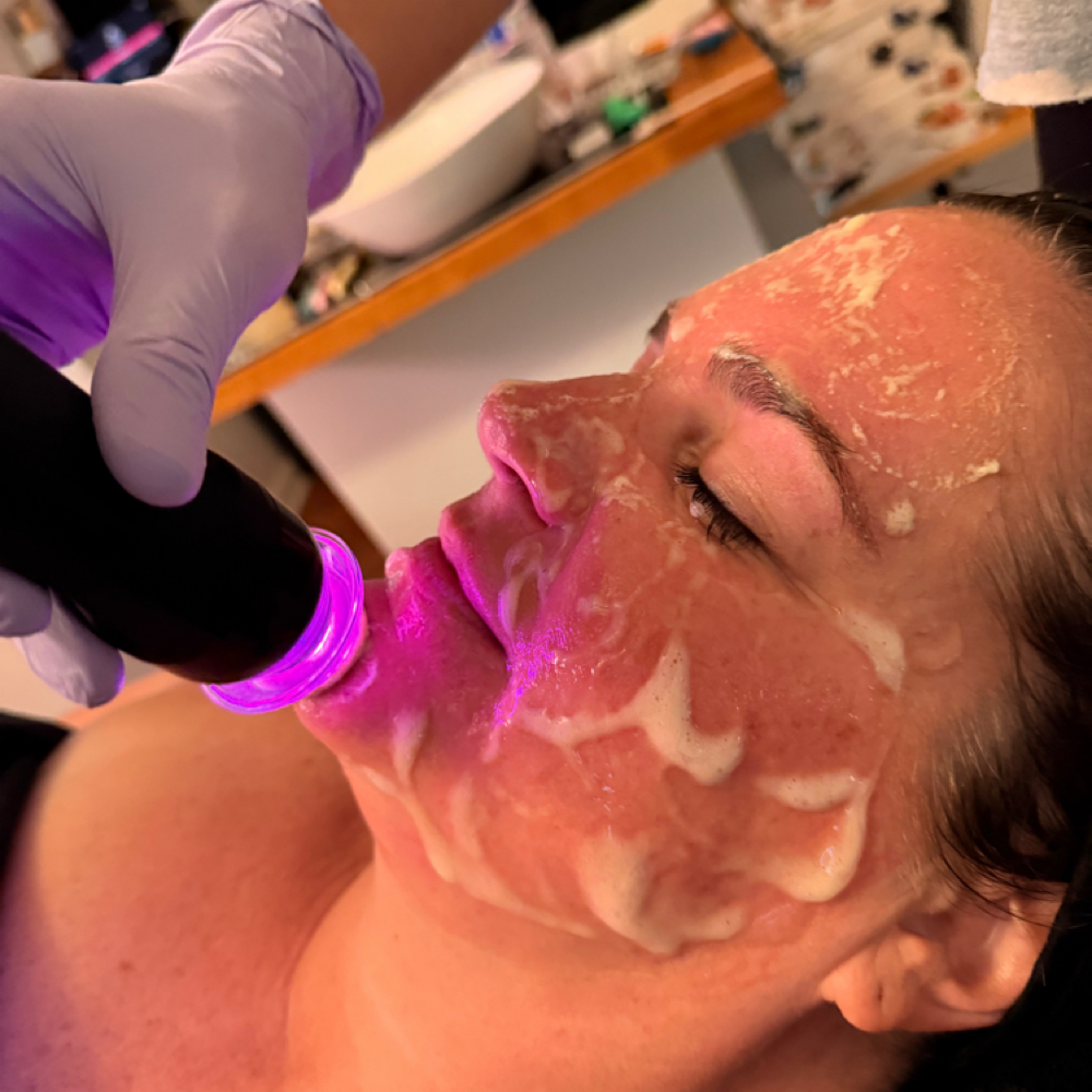 *NEW!* Glo2 Facial at Elite Esthetic Studio in Millersville, MD