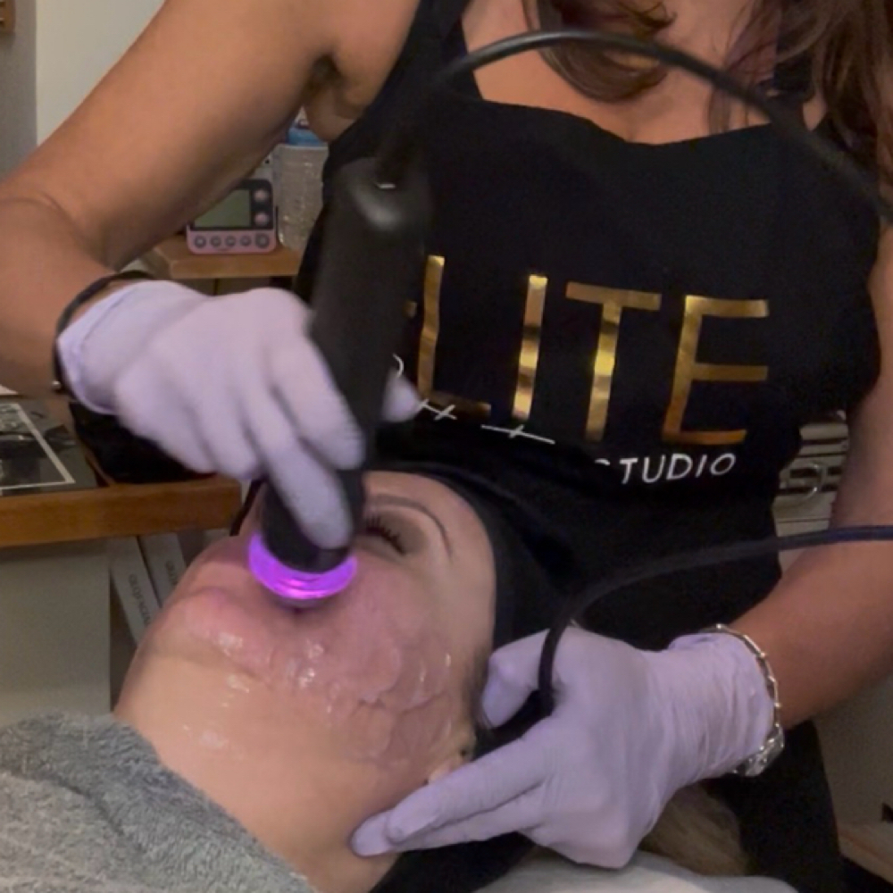 *NEW!* Glo2 Facial at Elite Esthetic Studio in Millersville, MD