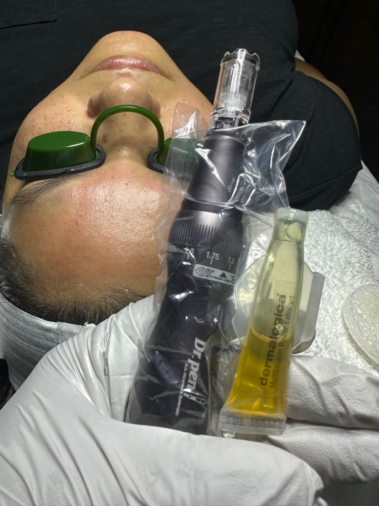 Nano Infusion