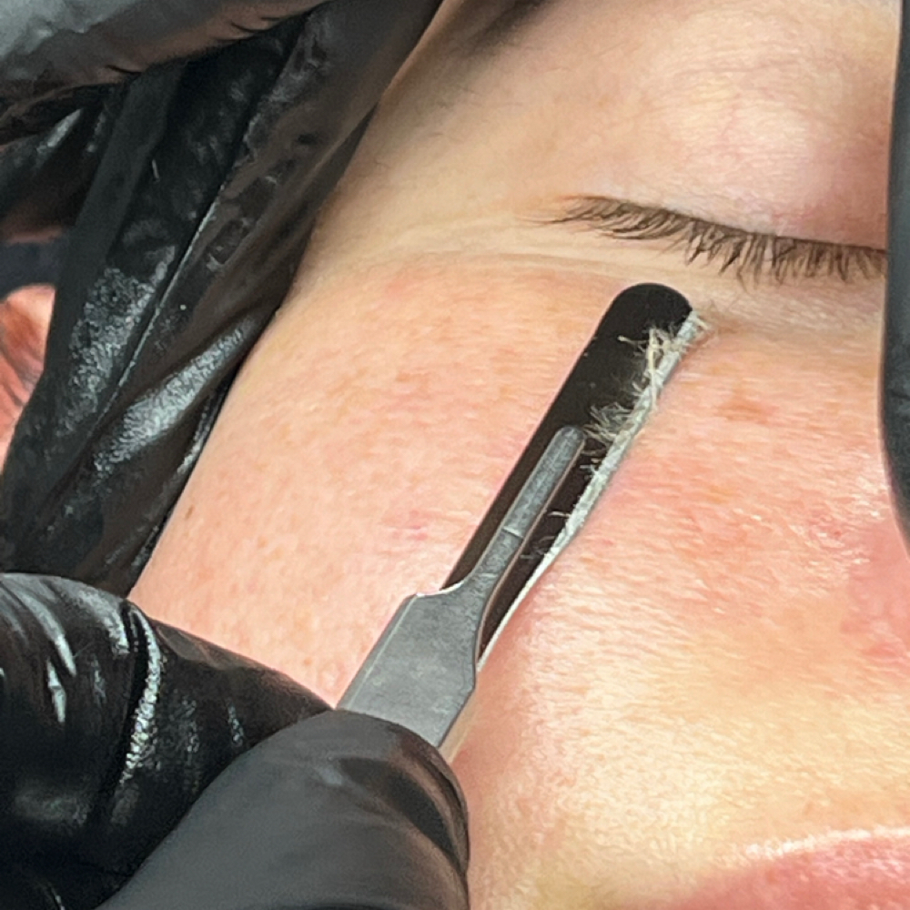 Express Dermaplaning at Dream Skin & Beauty in New York, NY