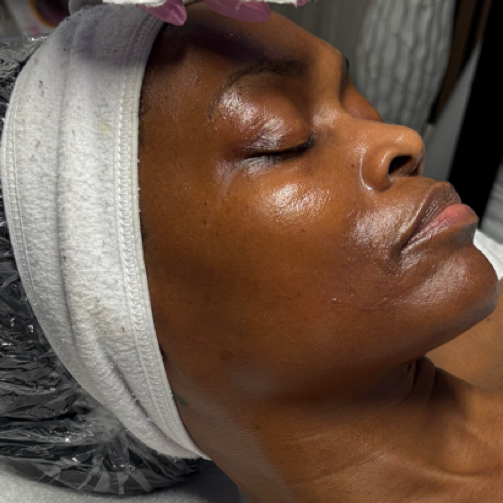 Dermaplane + Nano Infusion