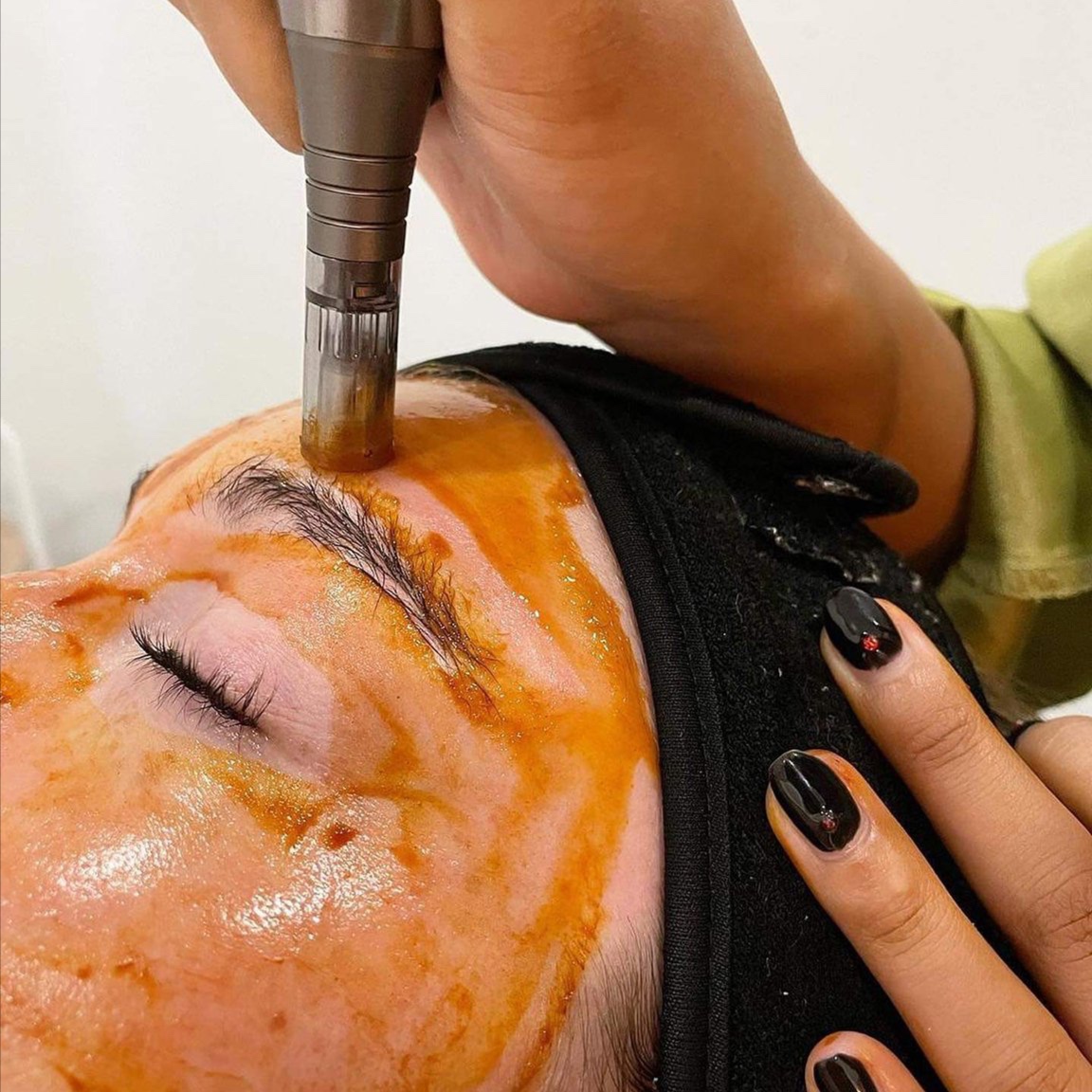Facial Infusion at SoLuna Aesthetics in Scottsdale, AZ