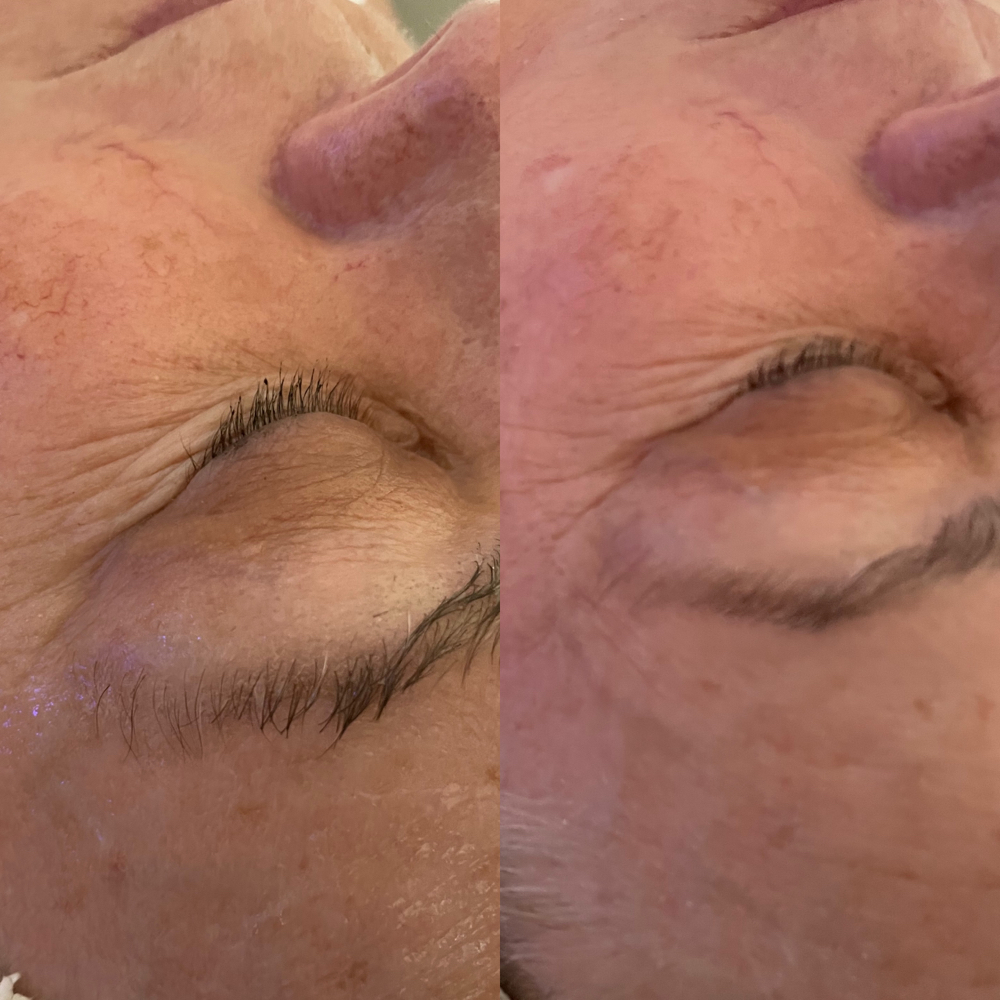 Age defying Microcurrent