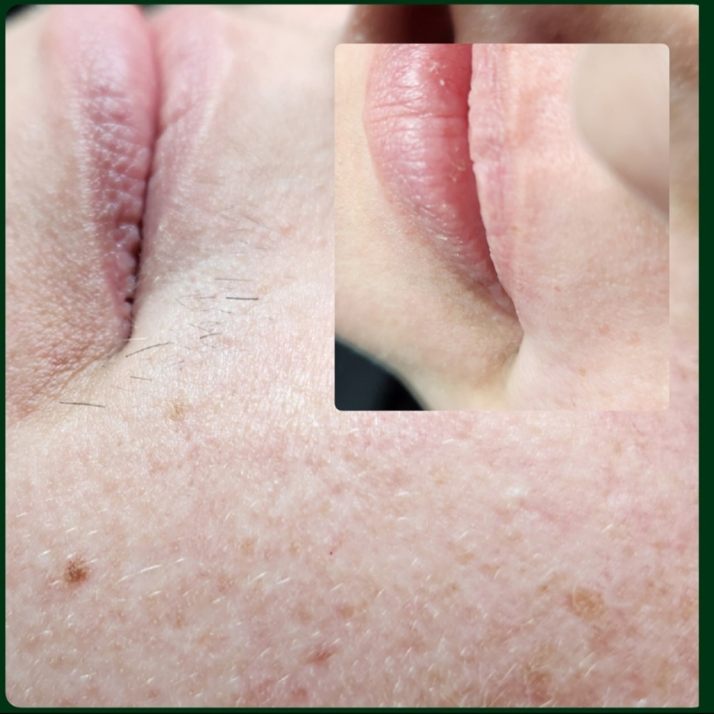 Lip at Evermore Esthetics in Gravette, AR