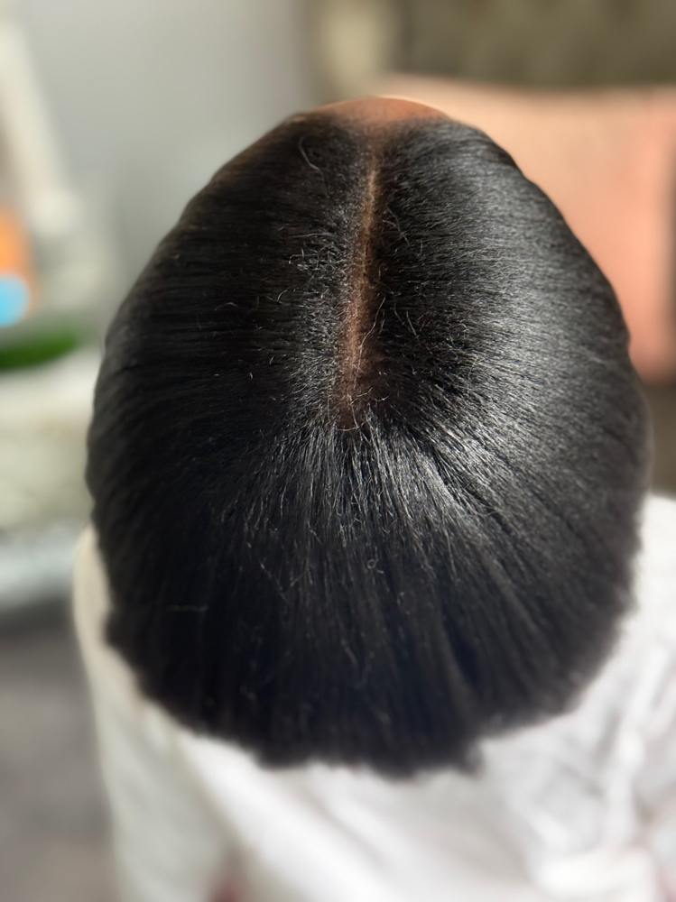 Scalp Rejuvenation Therapy