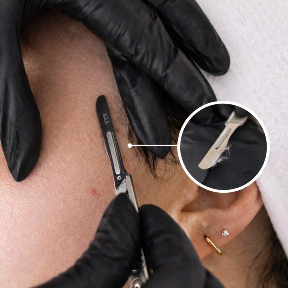 Dermaplaning Facial at Sol & Skin Wellness in Duncanville, TX