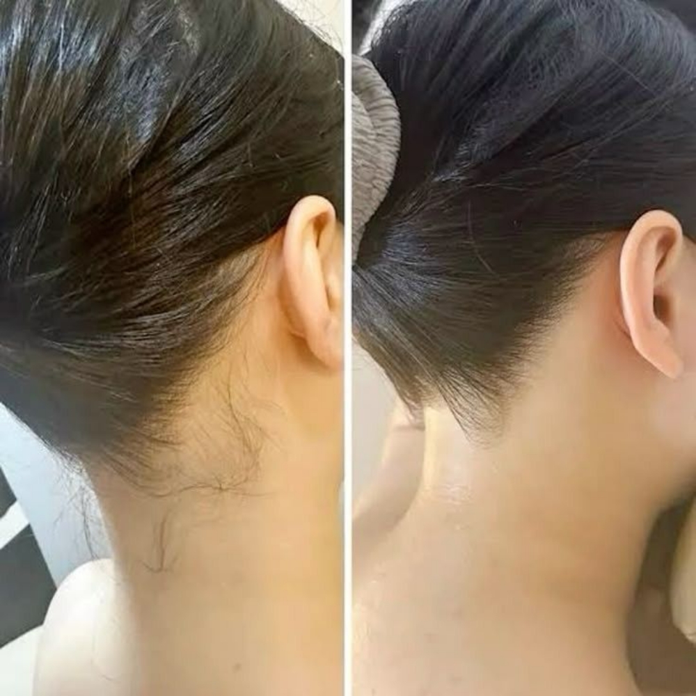 Neck at Esther-tician in Ridge, NY