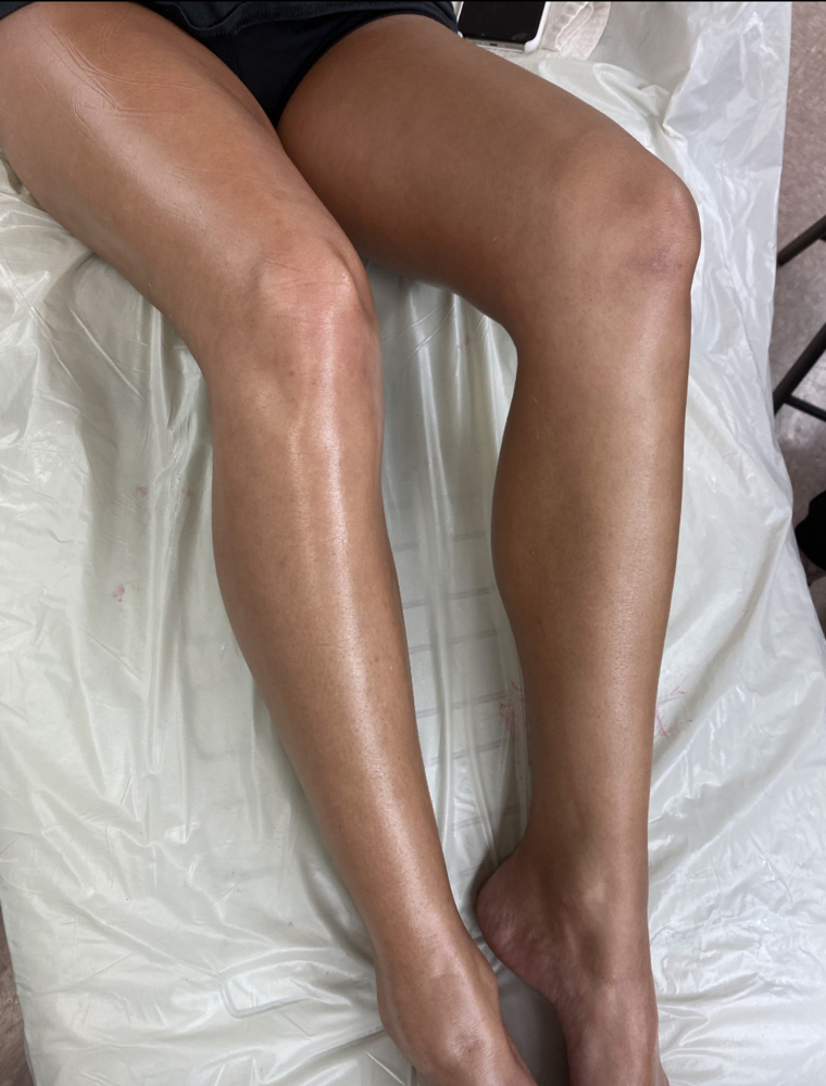 Full Leg Wax