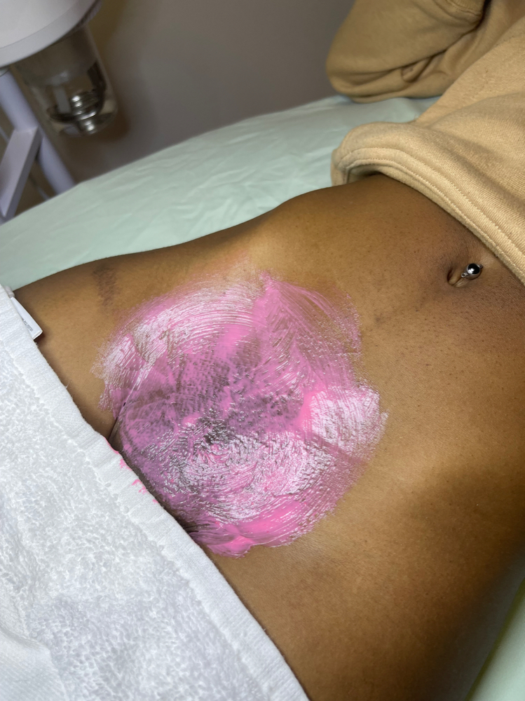 Brazilian Wax + Vajacial