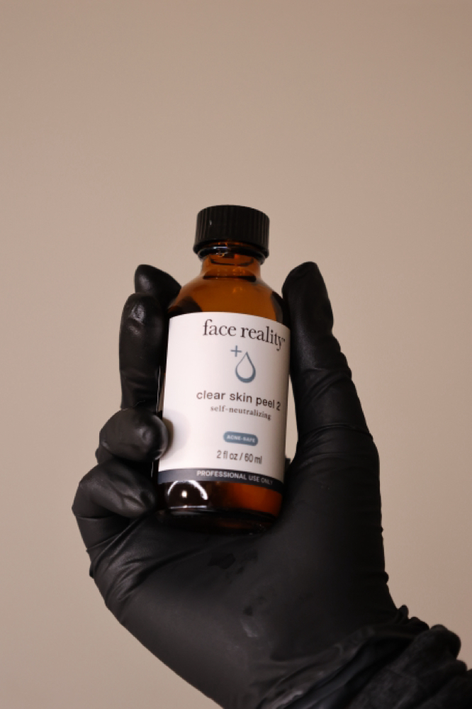 Acne BootCamp 2 Week Treatment