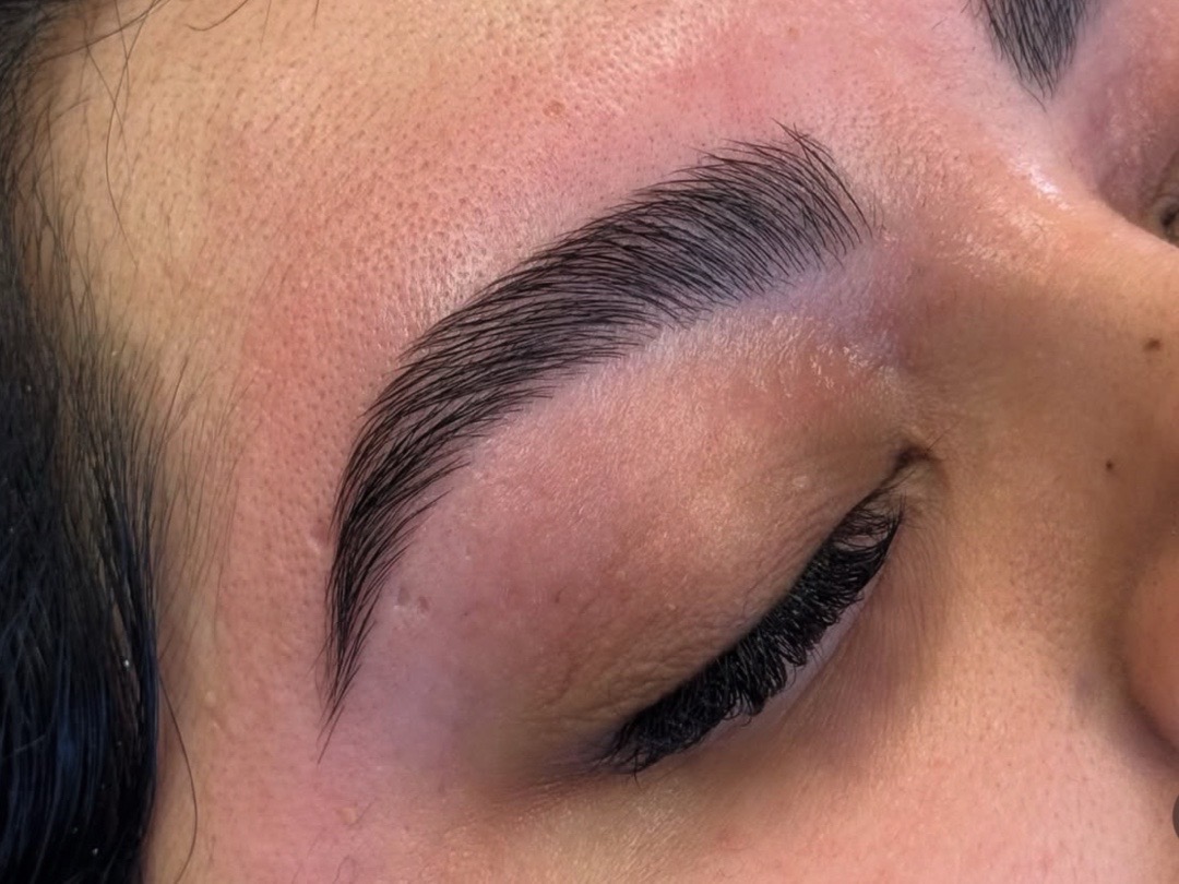 Brow Lift & Sculpt