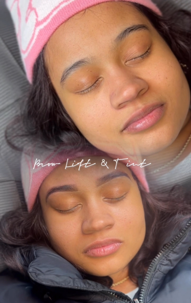 The Ultimate Brow Lift