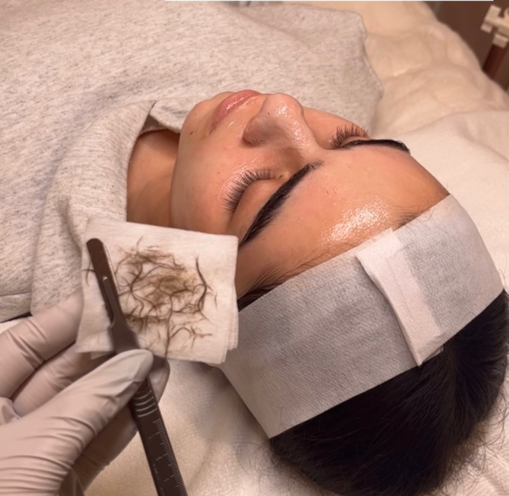 Dermaplane Facial