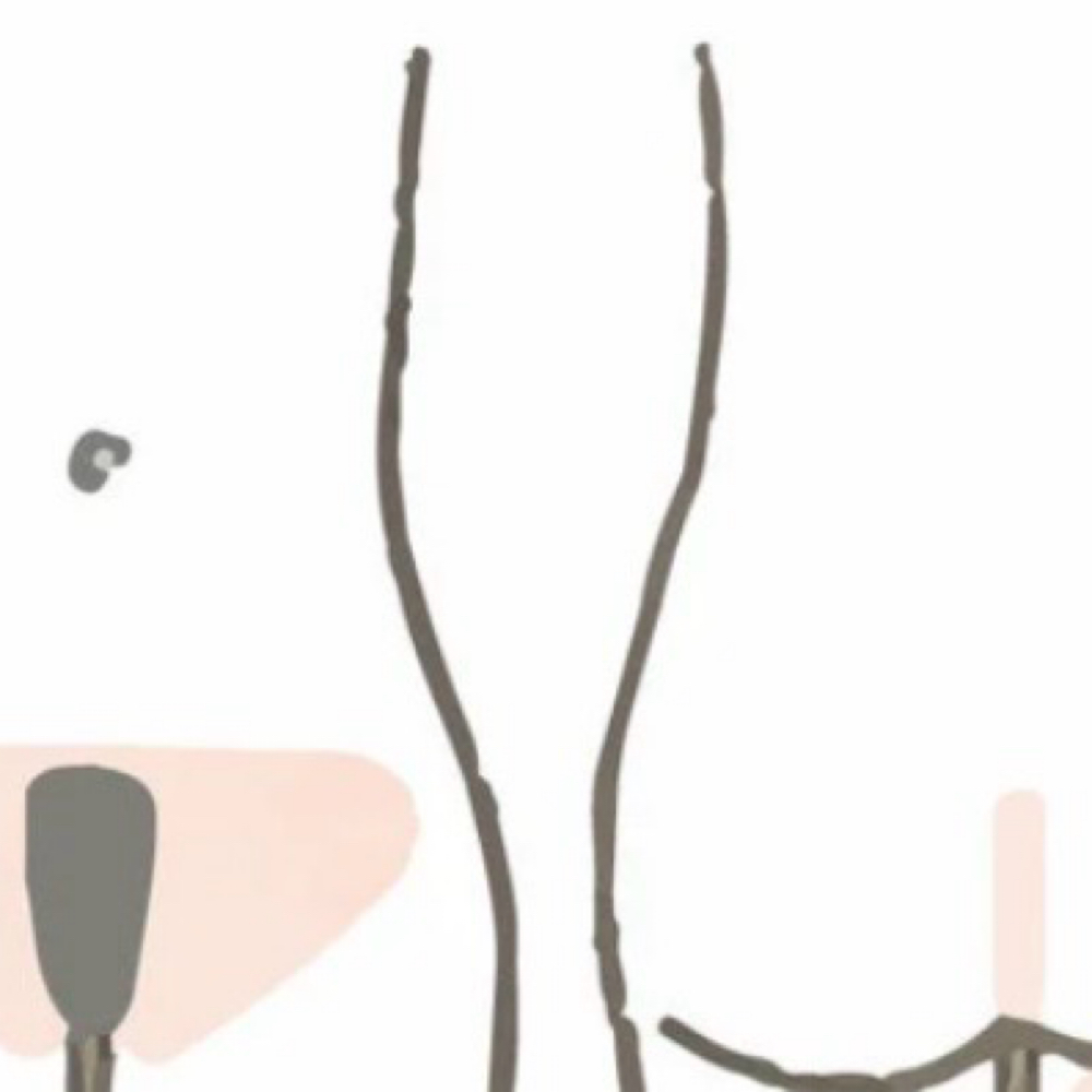 BRAZILIAN WAX at arbesthetics in dorcester, MA