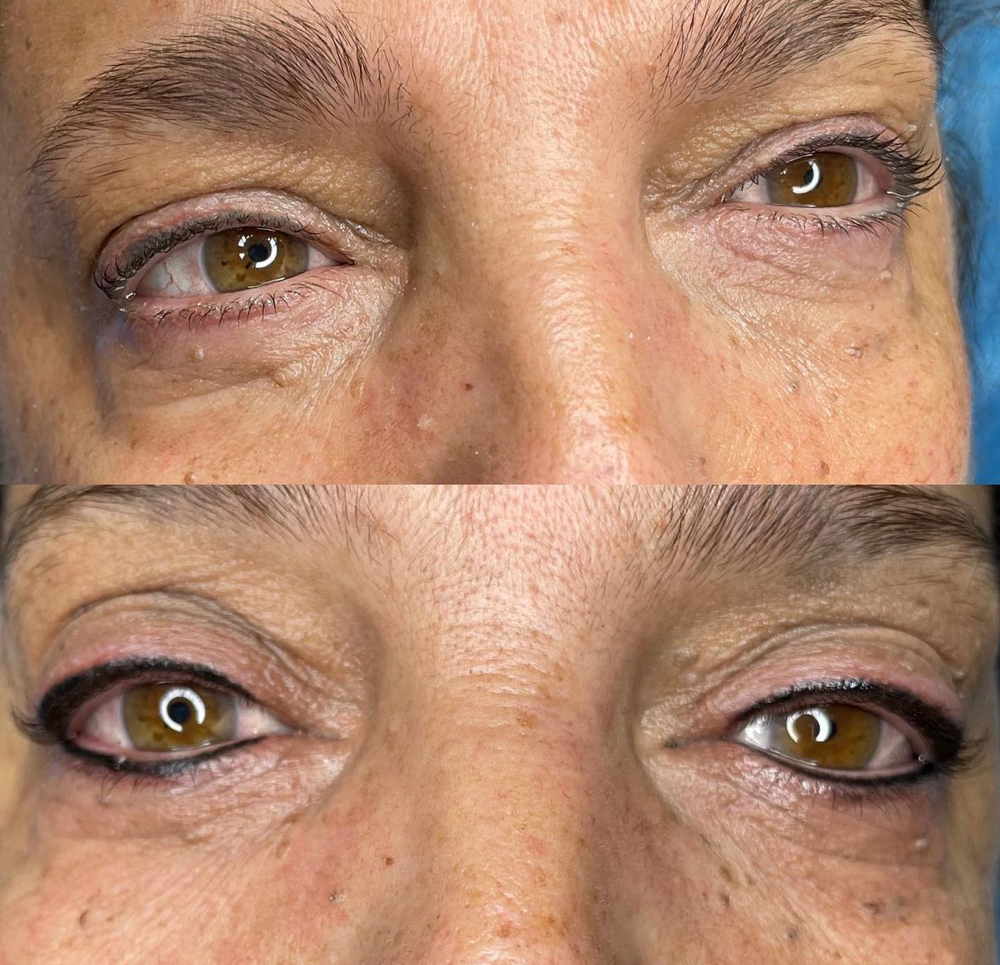 Eyeliner (Top Only)