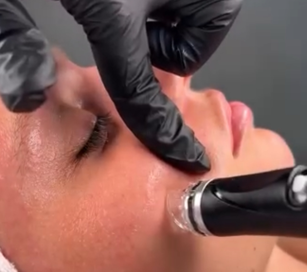 HydraFacial