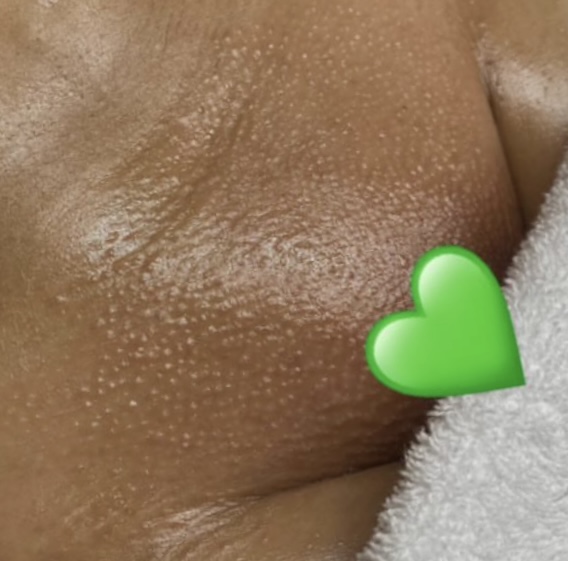 Brazilian Wax (Women Only)