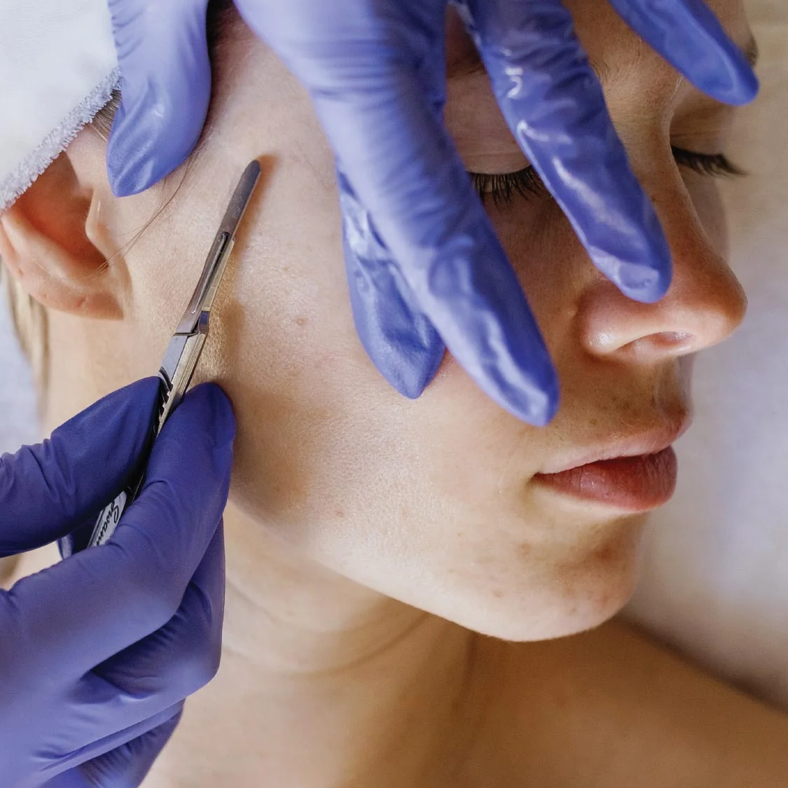 Dermaplaning facial