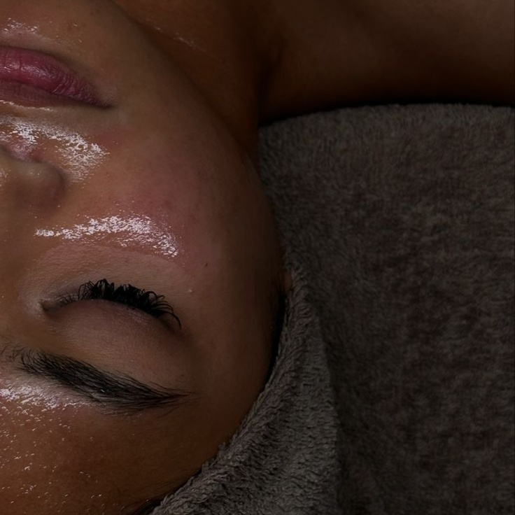 Acne Bootcamp: Chemical Peel at Kaiyani Esthetics in Nashville, TN