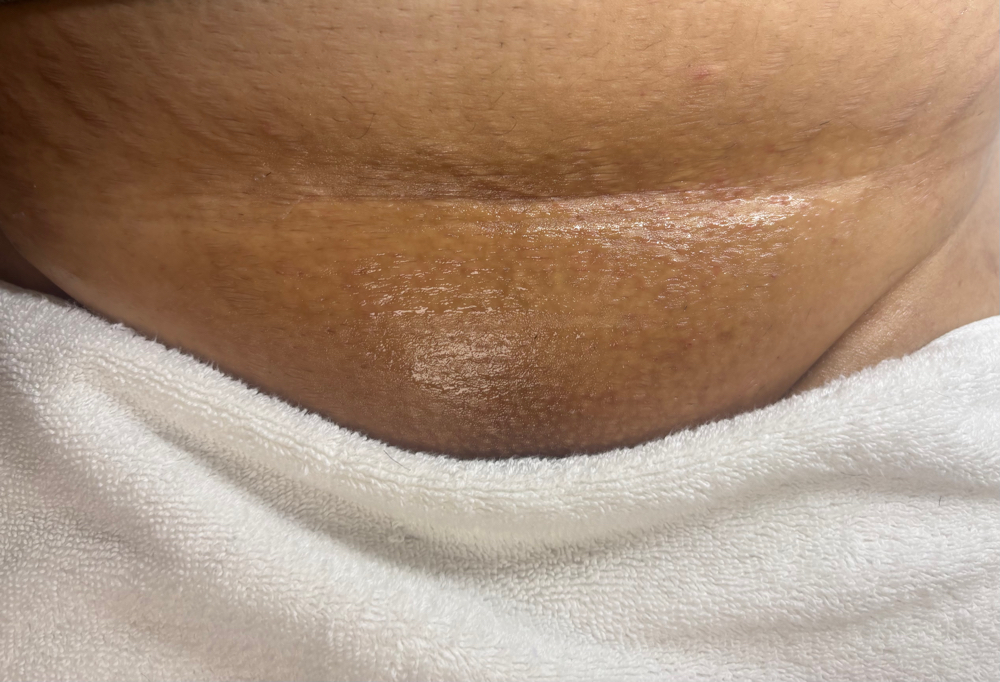 Brazilian Wax