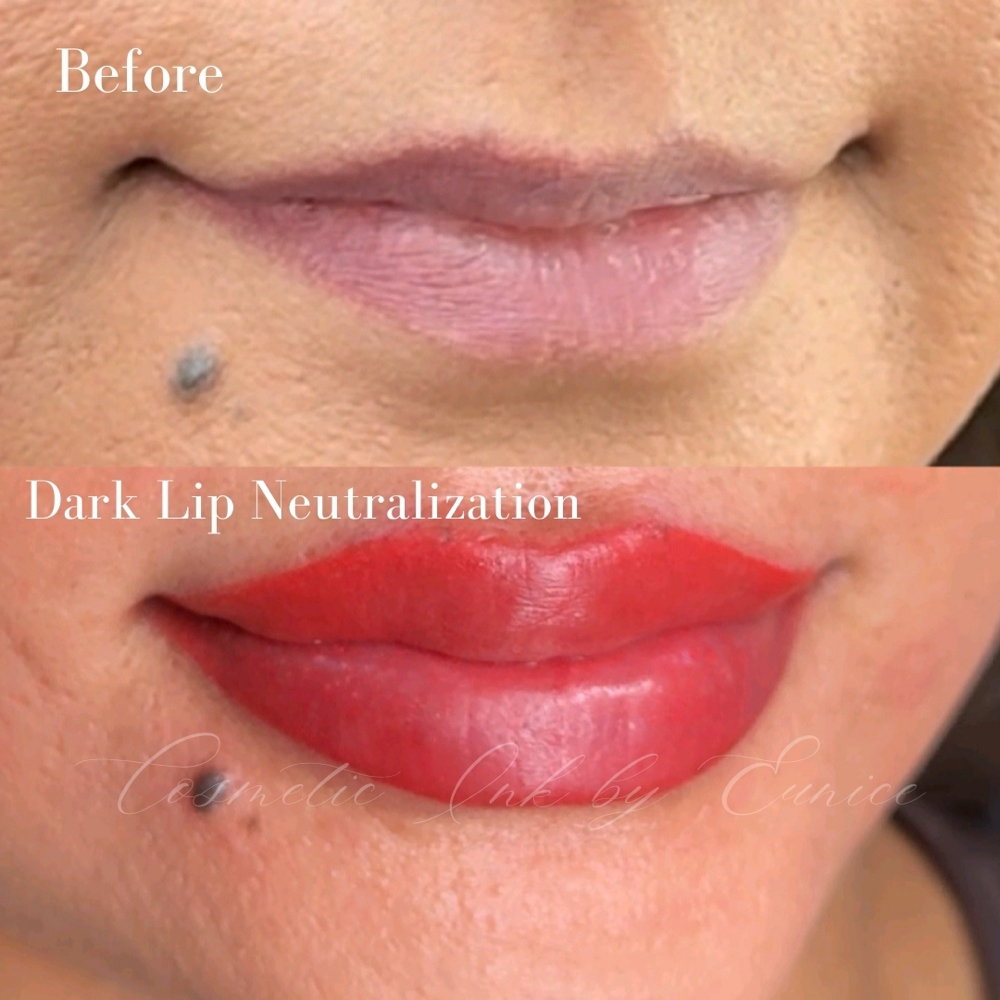 Lip Neutralization