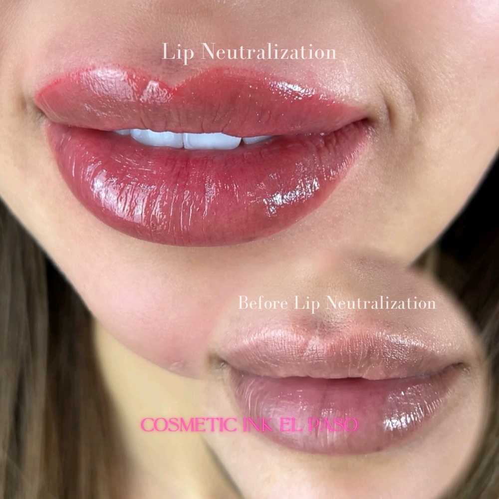 Lip Neutralization