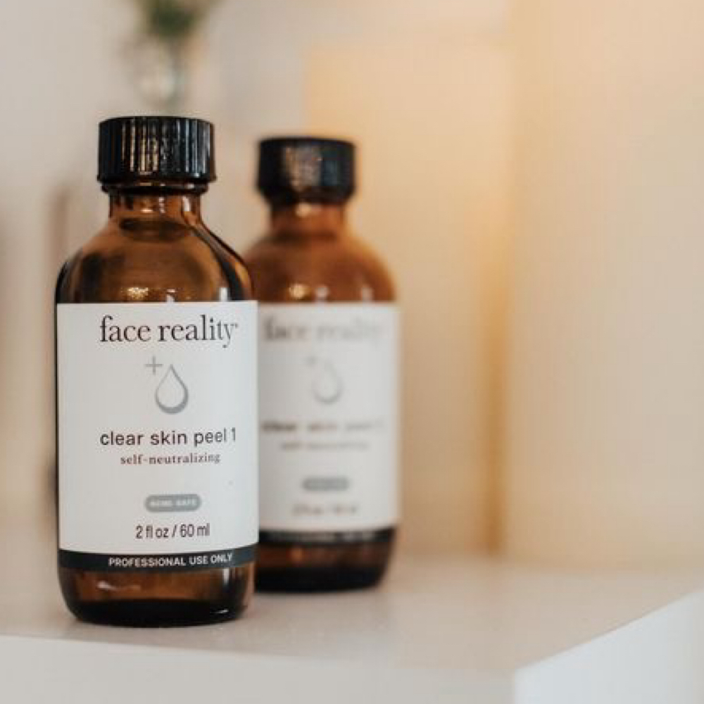 Chemical Peel at Soul to Skin Esthetics in Bend, OR