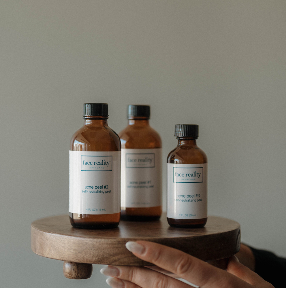 Acne Bootcamp Treatment